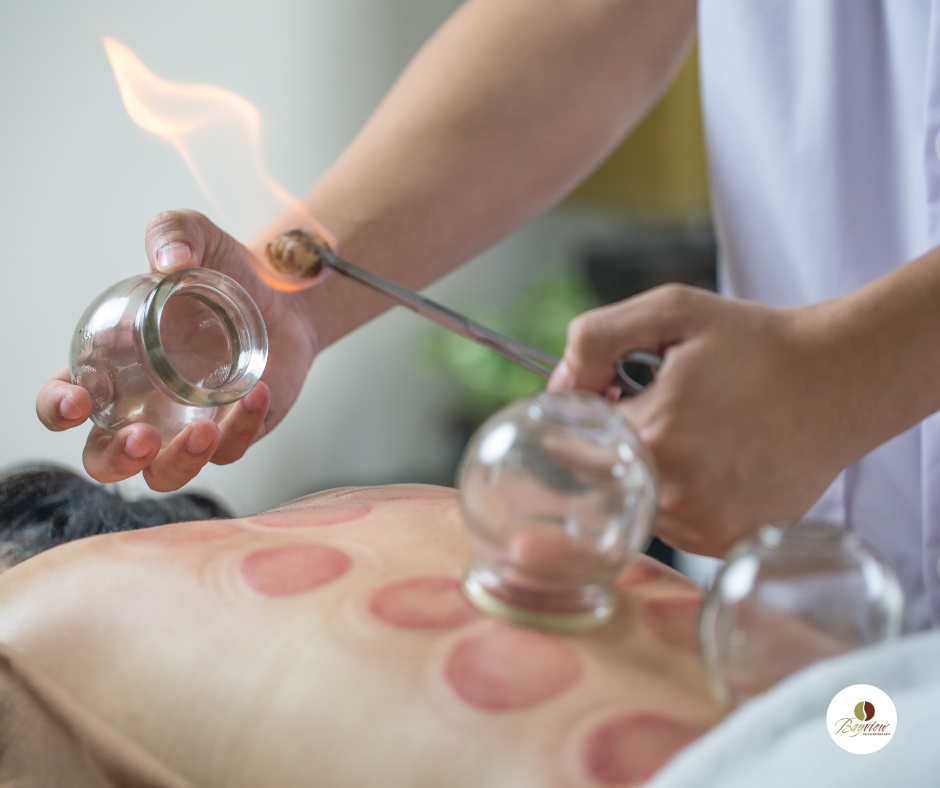 A close-up of an acupuncture needle poised above a human palm, alongside research papers and scientific data visualizations in the background. The image illustrates a blend of traditional and scientific elements, showcasing the credibility of acupuncture services.